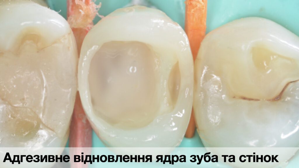 _Кейси по адгезиї._013