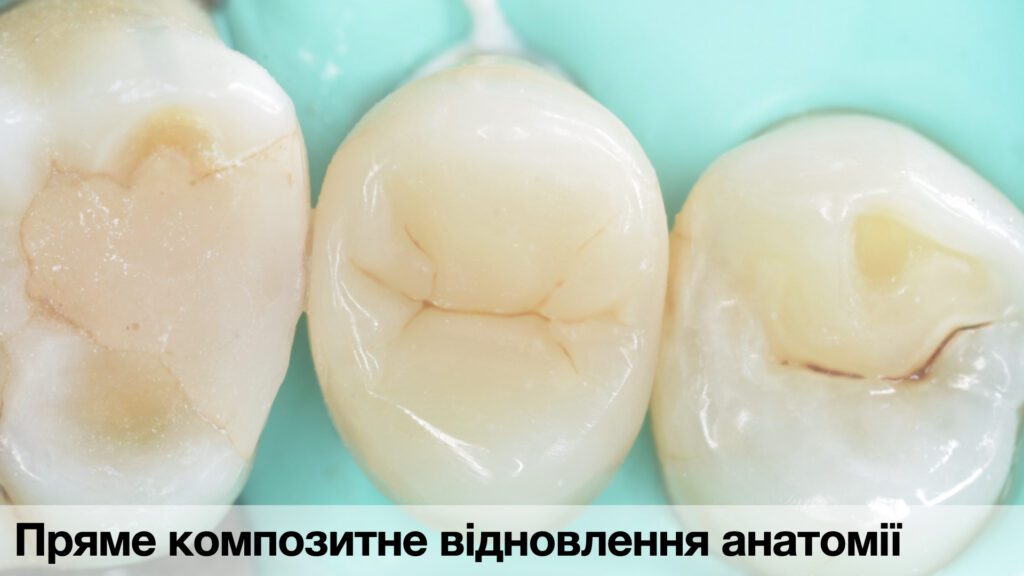 _Кейси по адгезиї._014