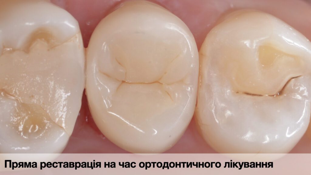 _Кейси по адгезиї._015